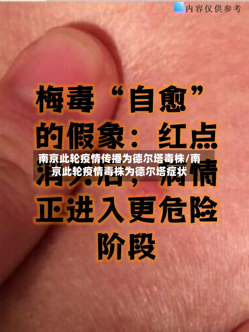 南京此轮疫情传播为德尔塔毒株/南京此轮疫情毒株为德尔塔症状
